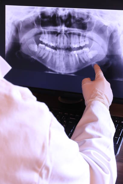 Best Emergency Wisdom Tooth Extraction in West Middlesex, PA